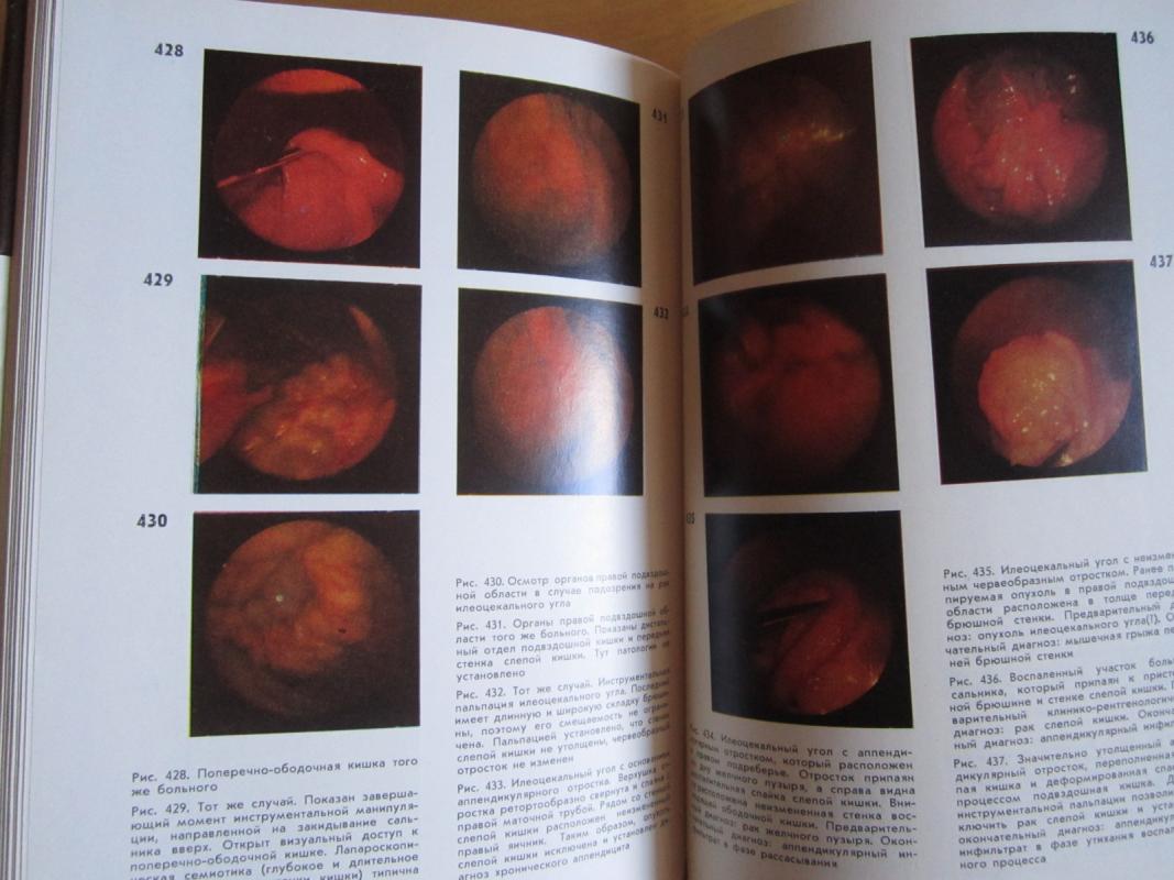 Atlas laparaskopiceskoj diagnostiki - E. G. Koval, knyga 5