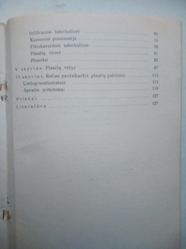 Kai kurių plaučių susirgimų diferencinė diagnostika - A. Šalčiūtė, knyga 3