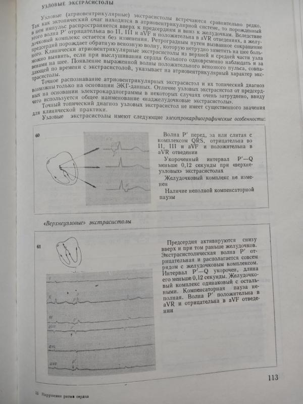 Širdies ritmo sutrikimas - Prof. L.Tomov doc.  Į.L. Tomov, knyga 4